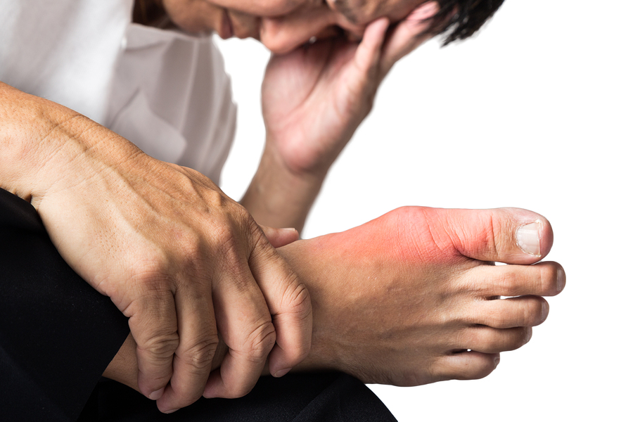 Effective Natural Remedies For Gout