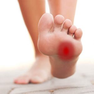 Fight with Morton’s neuroma boldly