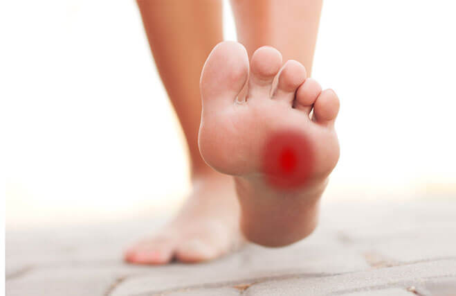 Fight with Morton’s neuroma boldly