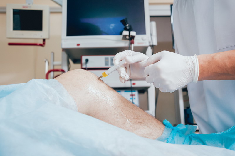 6 Things that Could Derail PRP Therapy