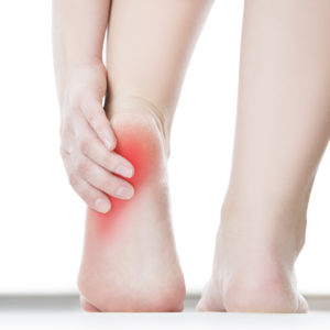 Before Plantar Fasciitis Treatment – Have the Patient Been Diagnosed Correctly
