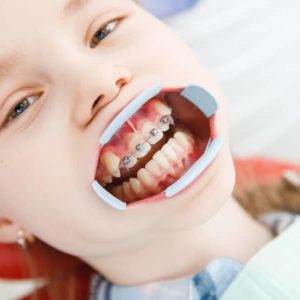 oral hygiene habit