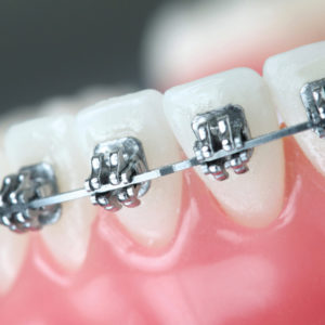 orthodontists