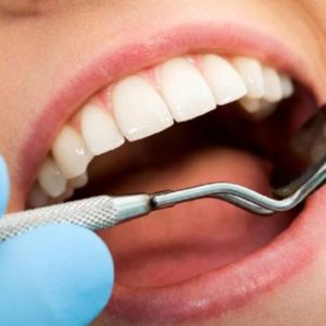 Tooth Decay