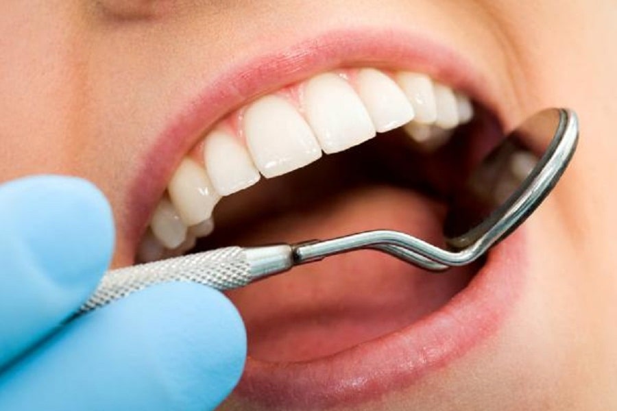 Tooth Decay