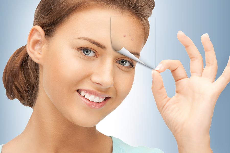 scar removal London