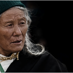 Ageing Skin