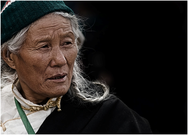 Ageing Skin