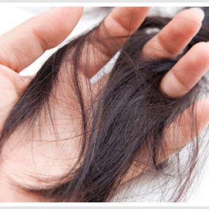 Hair Loss Patients