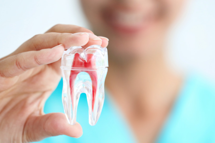 root canal