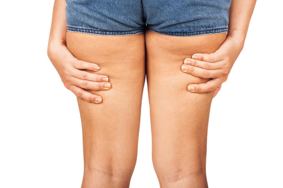 fighting cellulite