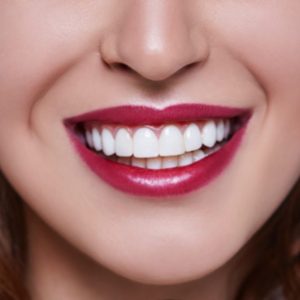 Useful Information About Dental Veneers