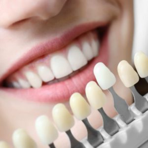 Cosmetic Dentistry