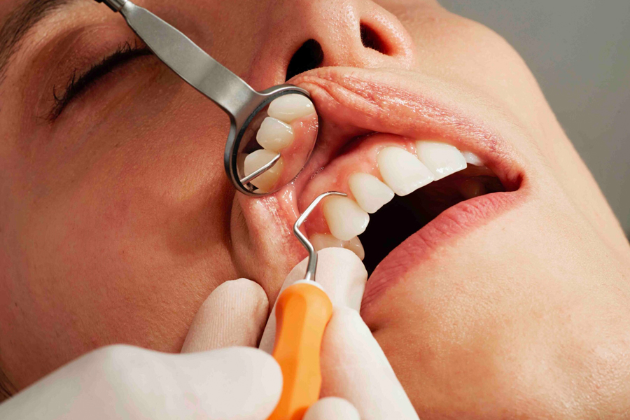 Various Options and Possible Side-effects of Cosmetic Dentistry Procedures
