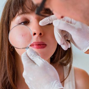 What to Look For in a Dermatologist