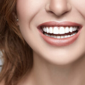 Why Do We Need Cosmetic Dentistry Services