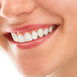 Transform Your Smile with Natomas Orthodontist Services