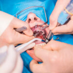 Oral Surgery Assessment Prior to Surgery Achieving Safety and Success