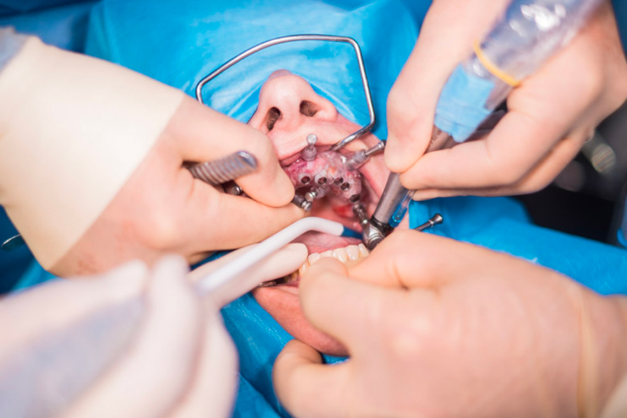 Oral Surgery Assessment Prior to Surgery Achieving Safety and Success