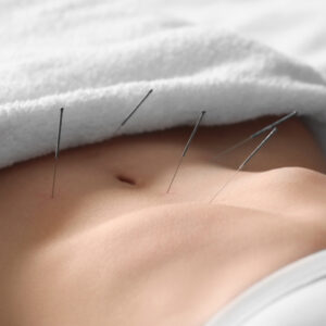 Acupuncture for Fertility Selecting the Right TCM Practitioner in Singapore