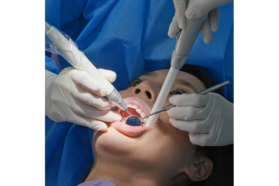 How Teeth Scaling and Polishing Addresses Yellow Teeth
