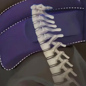 CerviCorrect Neck Brace Reviews My Personal Experience