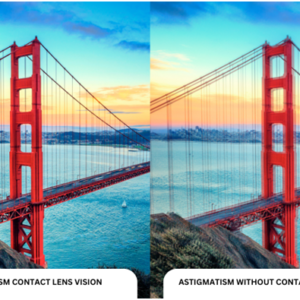 Astigmatism Contact Lenses in Singapore