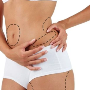 Waist Liposuction Cost in Dubai