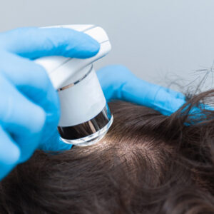 Hair Loss Isnt Hopeless How Restoration Help You Bounce Back