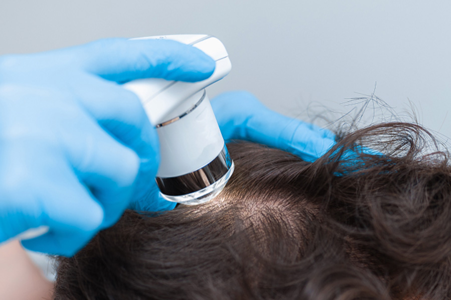 Hair Loss Isnt Hopeless How Restoration Help You Bounce Back