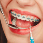 What dental treatments in Puchong can help improve your smile?