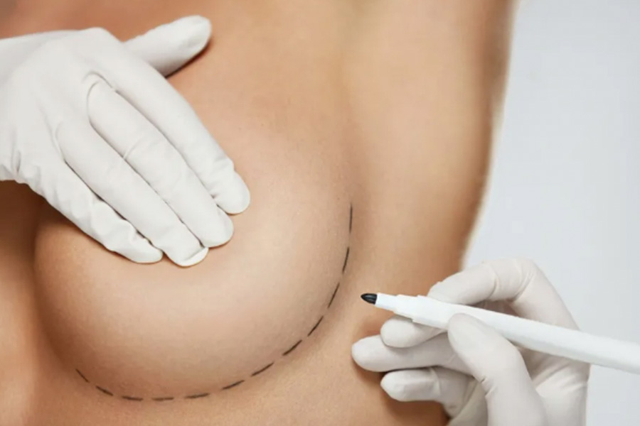 A Guide To Breast Augmentation In Singapore And Implant Types