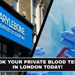 Should You Schedule a Private Blood Test in London Now or Wait