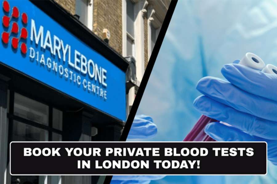 Should You Schedule a Private Blood Test in London Now or Wait