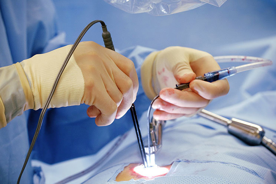 Minimally Invasive Surgery Training A Must For Modern Surgeons