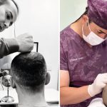 5 Reasons to Choose a Hair Transplant Turkey