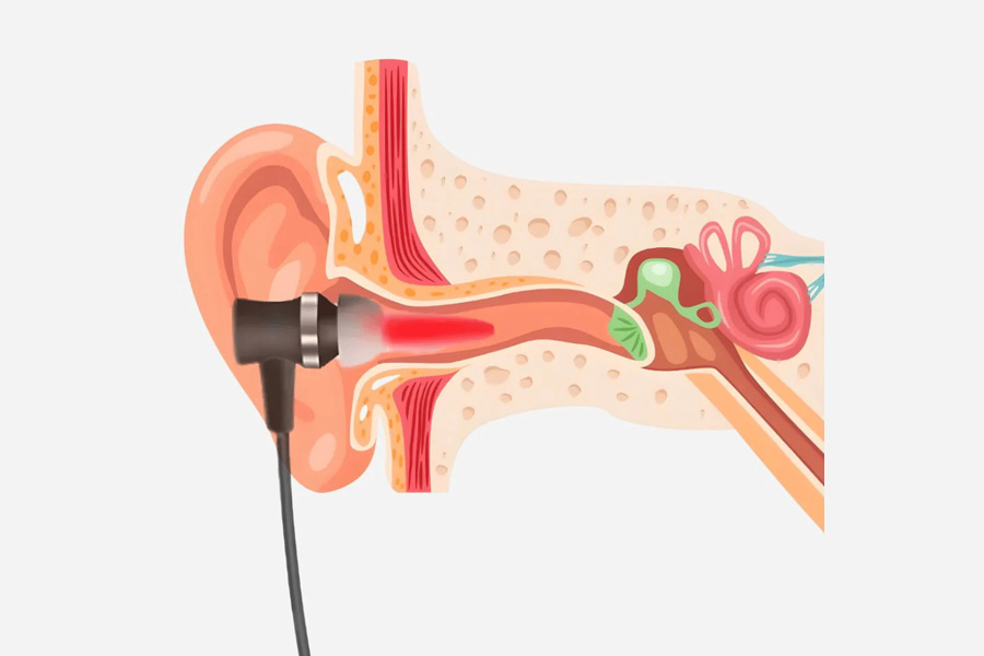 ReHears Reviews Does It Fit Every Ear